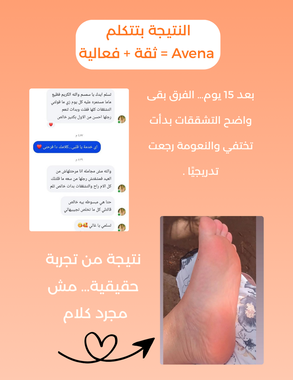 كريم تقشير
